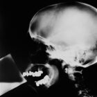 Isa Genzken [1991] X-Ray. Gelatin silver print, 100 x 80 cm.