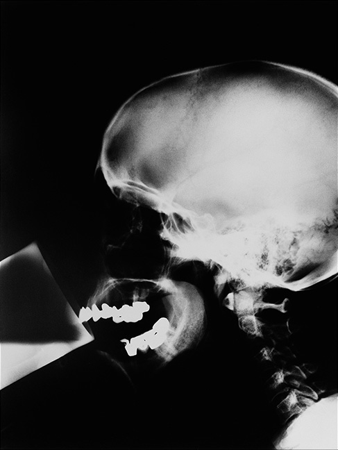 Isa Genzken [1991] X-Ray. Gelatin silver print, 100 x 80 cm.