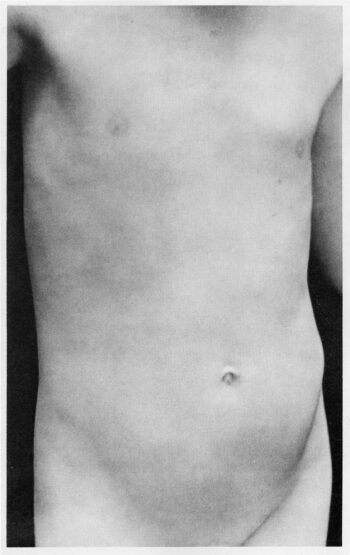 Sherrie Levine [1980] Untitled (After Edward Weston). Gelatin silver print.