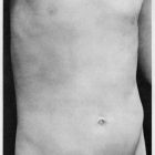 Sherrie Levine [1980] Untitled (After Edward Weston). Gelatin silver print.